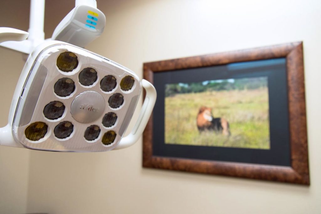 close up of oral exam mobile lighting equipment and bright framed picture of lion at immaculate dental experience on camera by danielle jacqueline photography near memphis tn