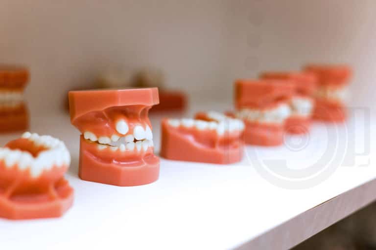 teeth 3d diagrams for pediatric dentist to explain types of oral problems kids face in office on white shelf strict focus by photographer in desoto county mississippi